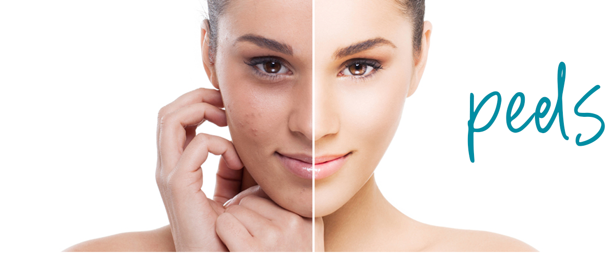 close upon woman with half of face clear and half acne